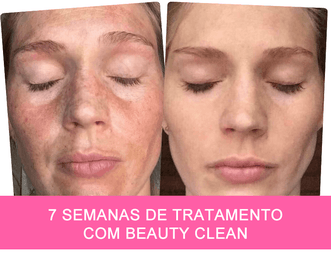 beauty clean antes e depois